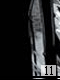 Slender 11